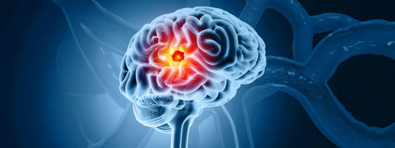 brain