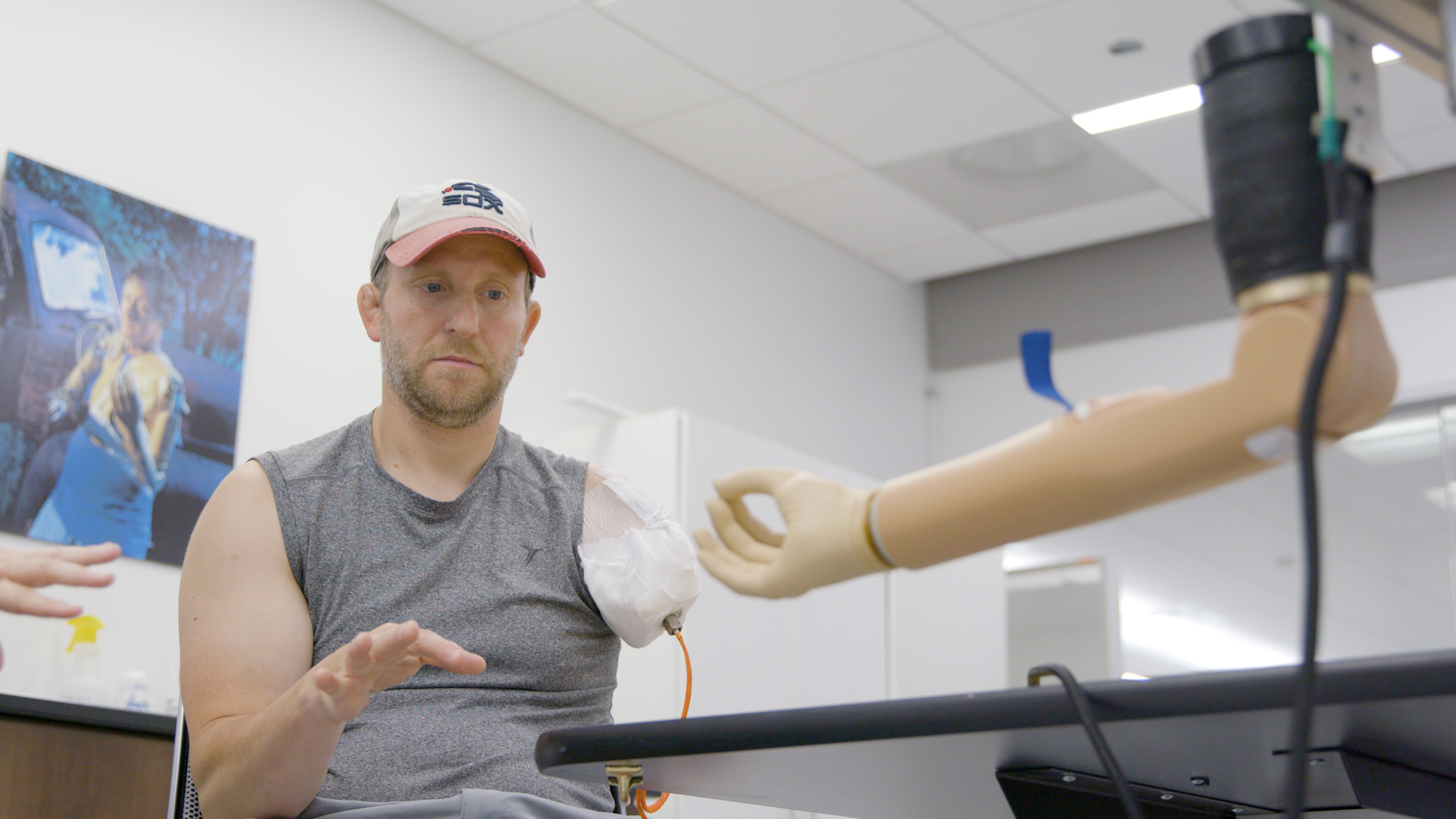bionic arm