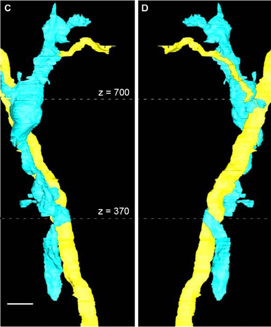 3D reconstruction of a collagen cable (yellow) and collagen producing cell (blue)