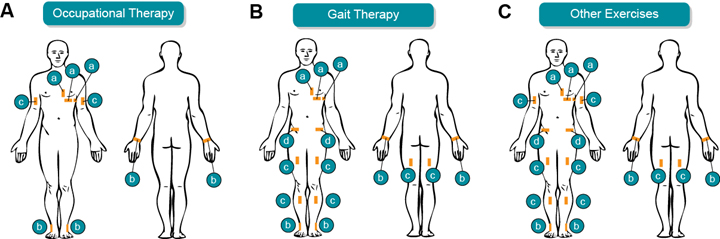 BioStampRC placement for inpatient exercise assessment