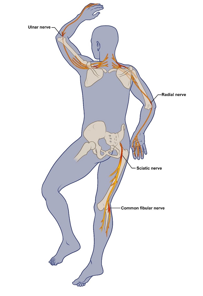 illustration of nerve damage