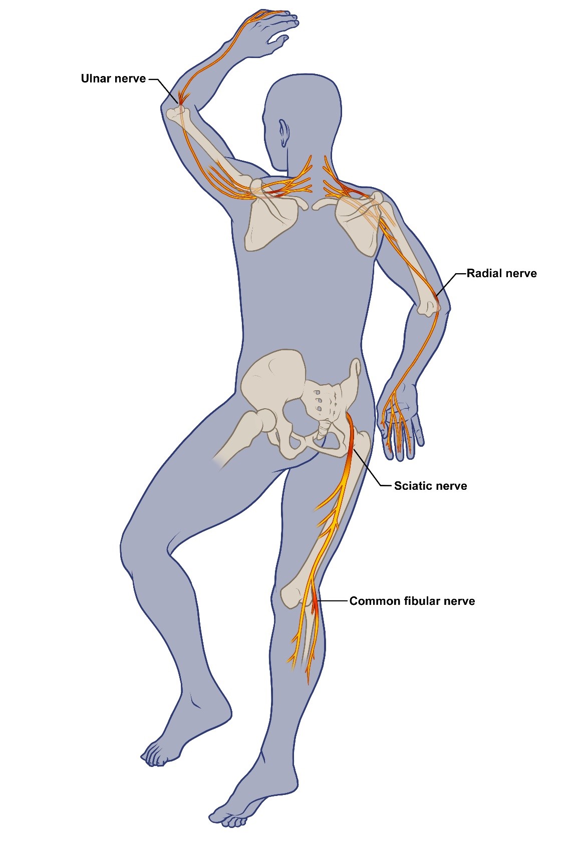 Nerve Damage Sites from COVID