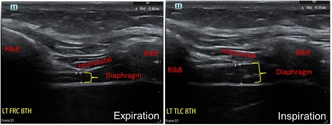 black and white diaphragm study imagery