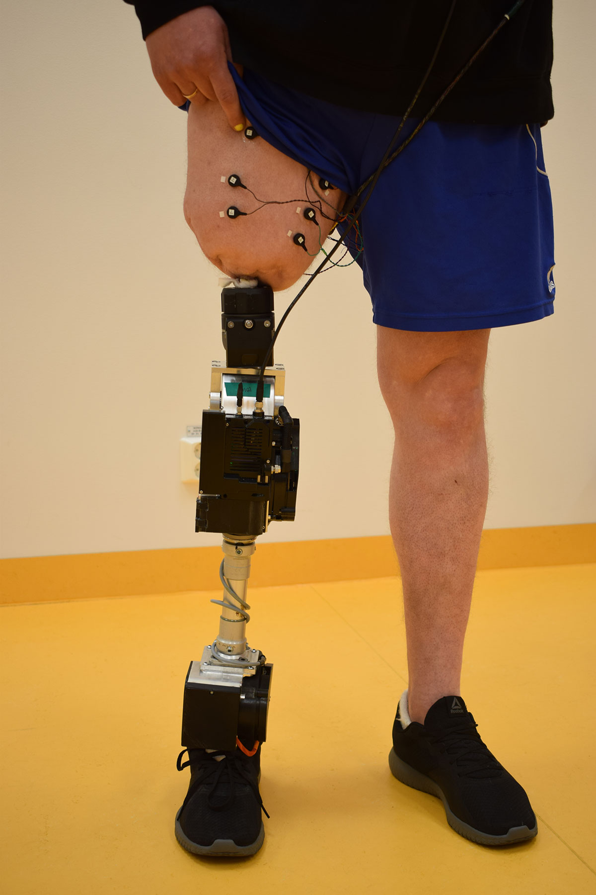 Bionic Leg