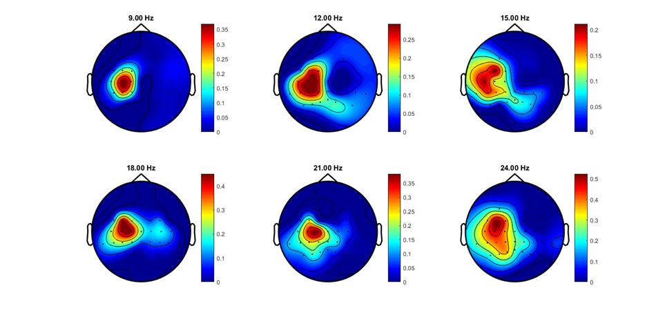 EEG Signals