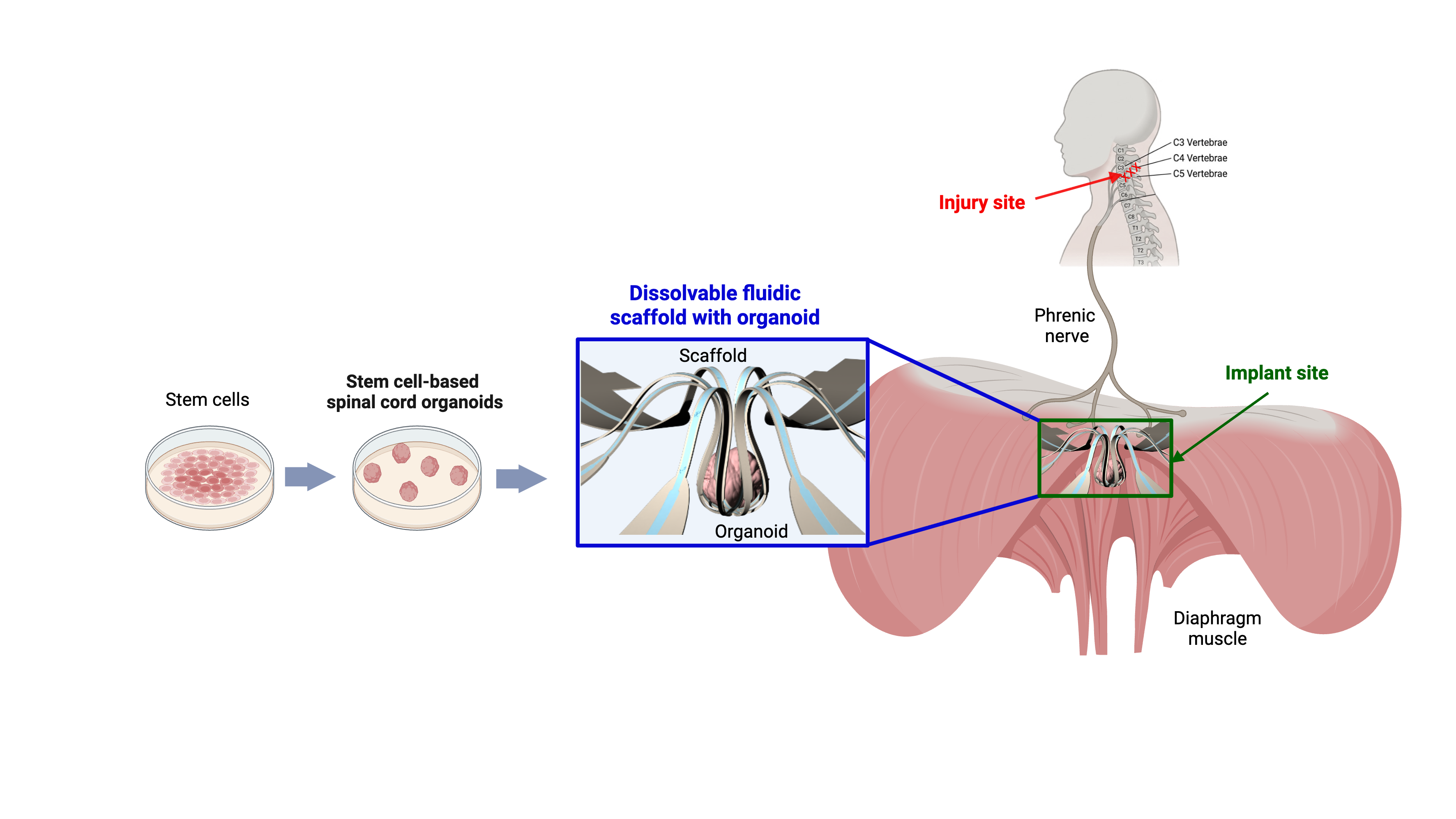 organoid infographic