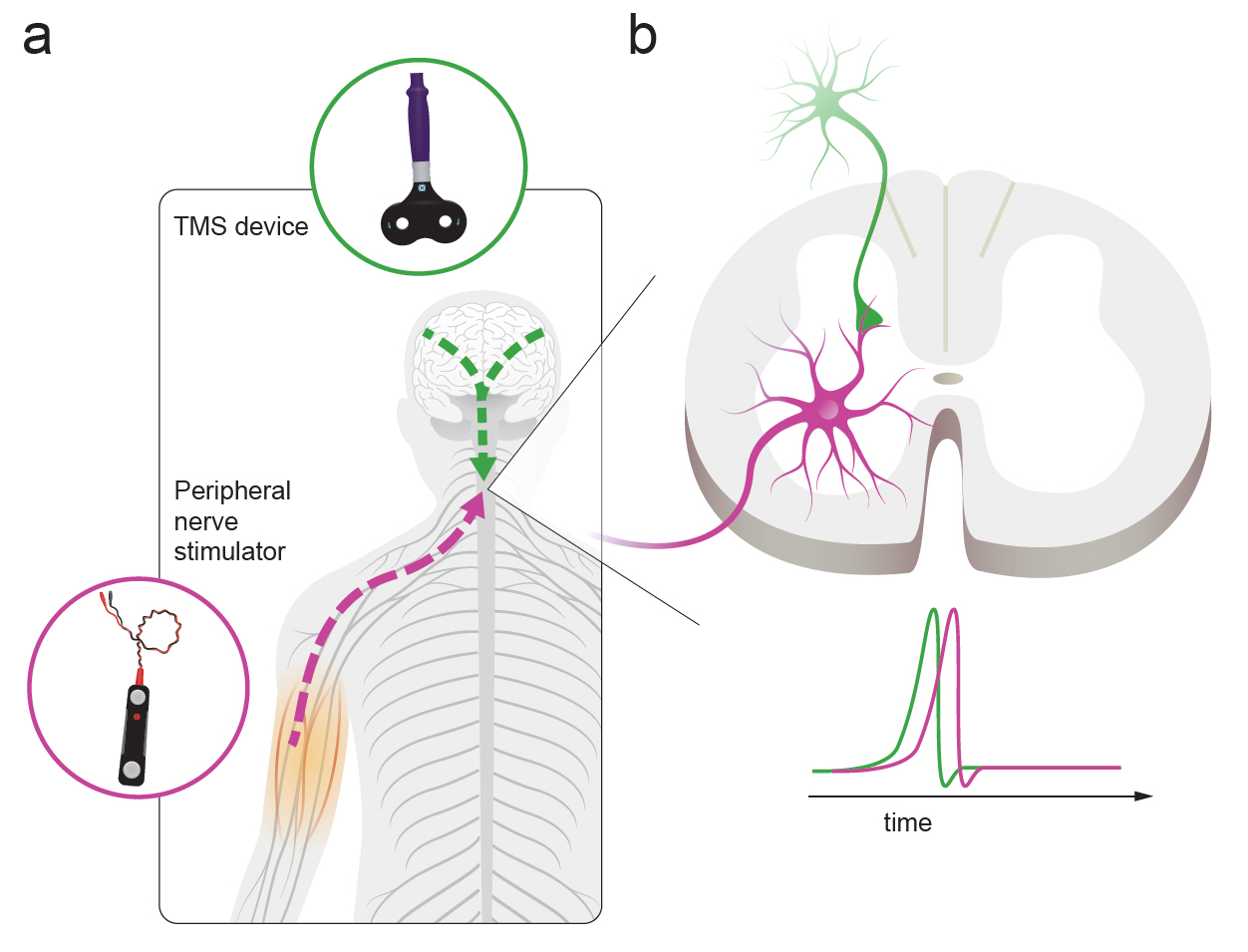 Neurostimulation Diagram