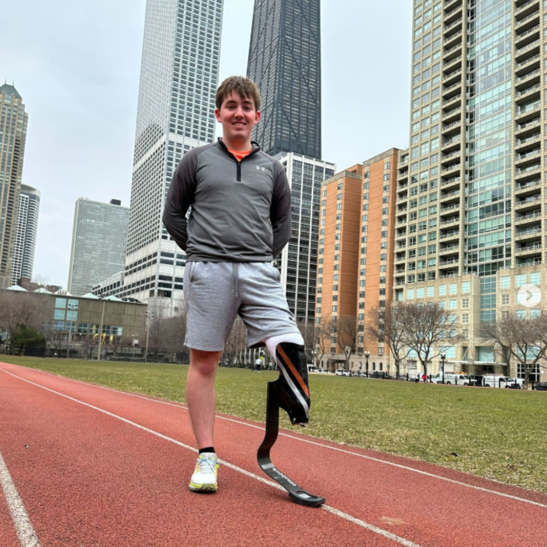 prostheses