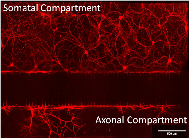 image of black and red axonal compartment