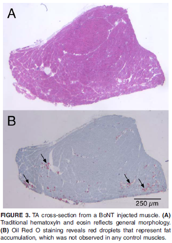 TA cross-section from a BoNT injected muscle