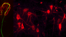 Neuromuscular junction and motorneurons