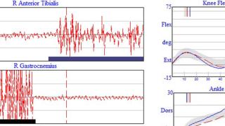 Kinematics and EMG reading charts