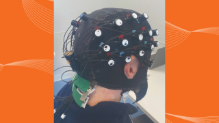 aphasia research
