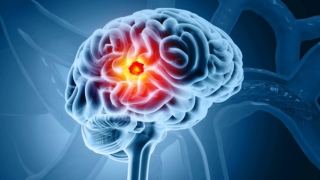 brain