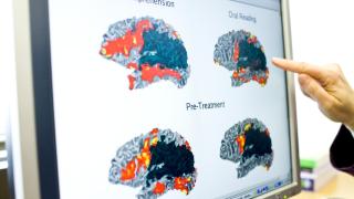 Intensive therapy programs look at the underlying cause of aphasia