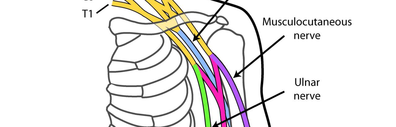 Diagram of nerves relevant in Targeted Muscle Reinnervation surgery