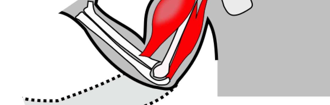 spasticity