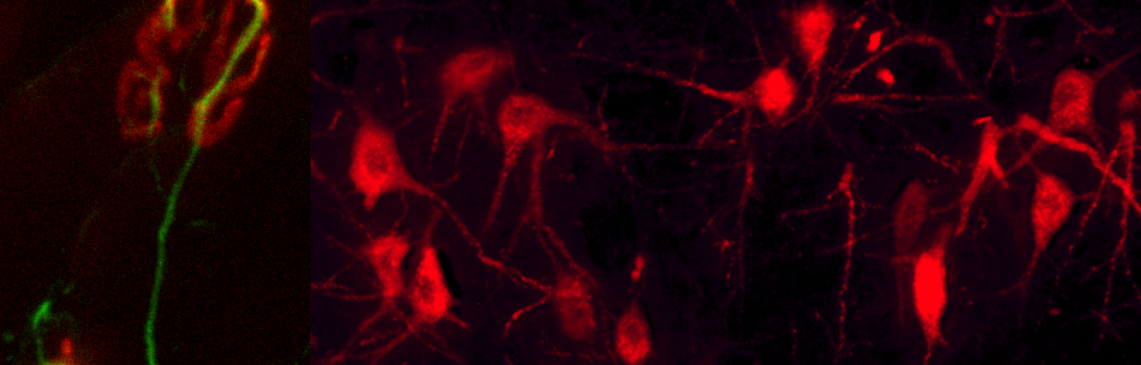 Neuromuscular junction and motorneurons