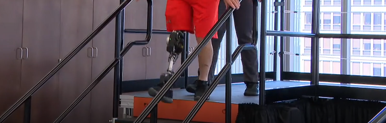 patient walking with new ai powered bionic leg