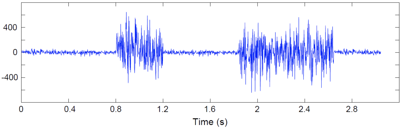 What EMG Signal may look like!