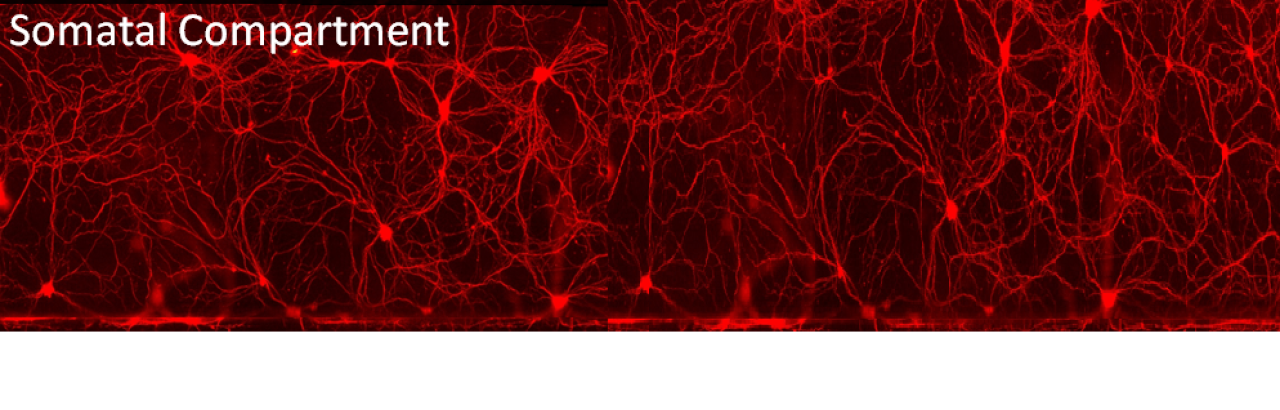 black and red microscopic somatal imagery