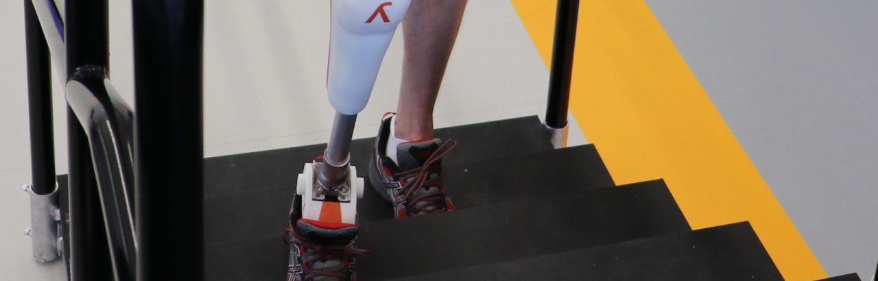 Hybrid Prosthetic Leg