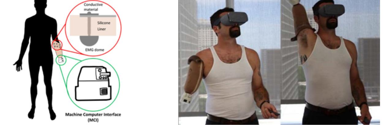 Virtual Reality to Treat Phantom Limb Pain