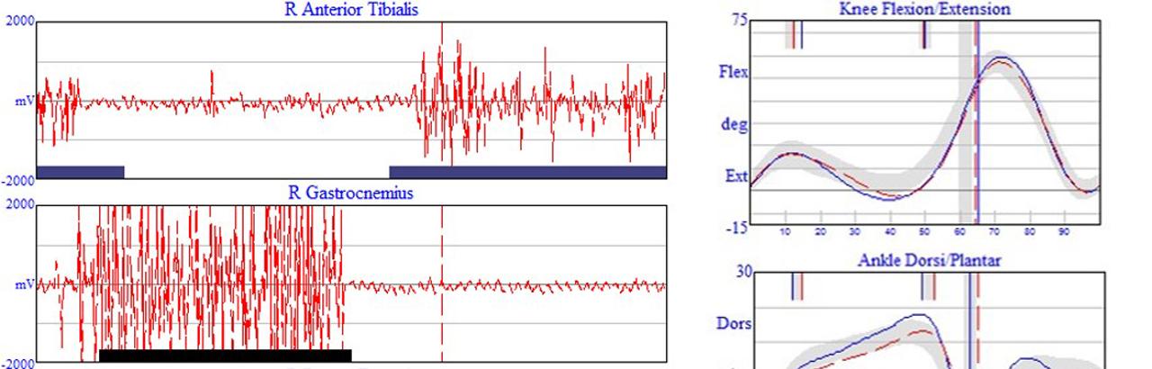 Kinematics and EMG reading charts