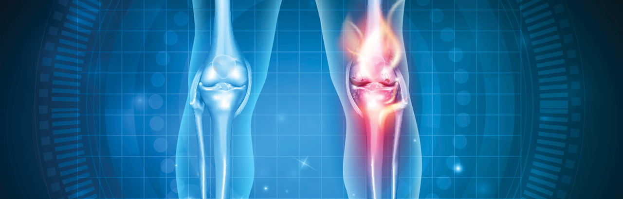 Medical illustration of a knee