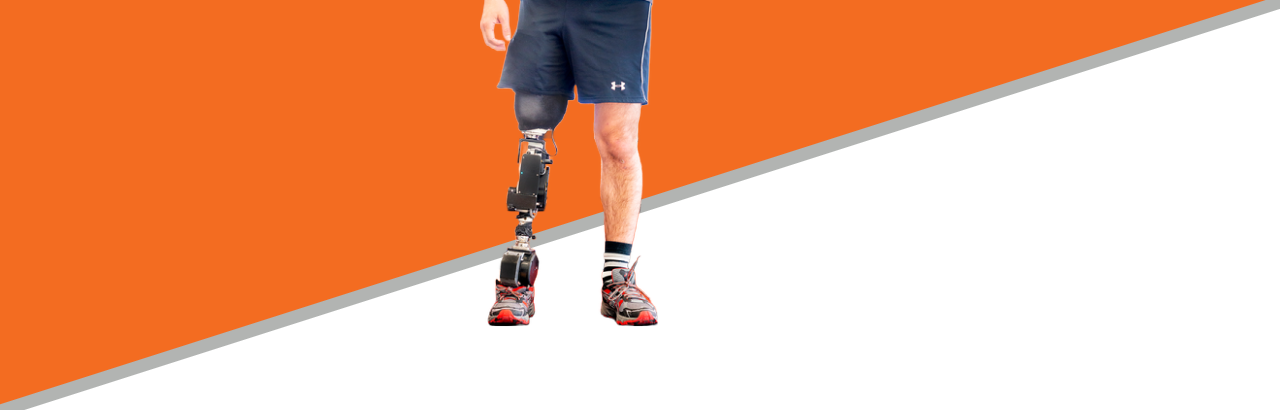 open source bionic leg