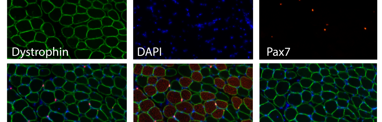 Muscle Stem Cells