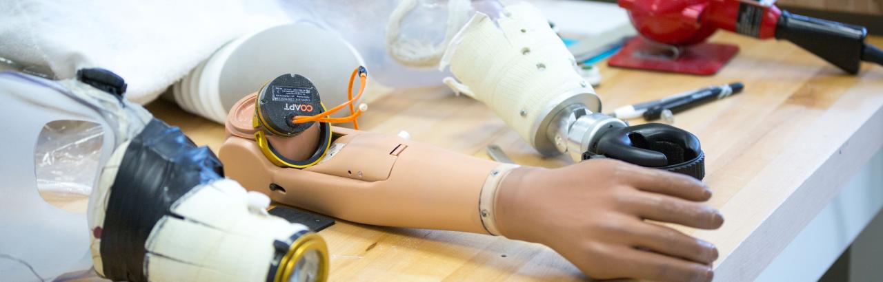 Example of upper limb prosthesis