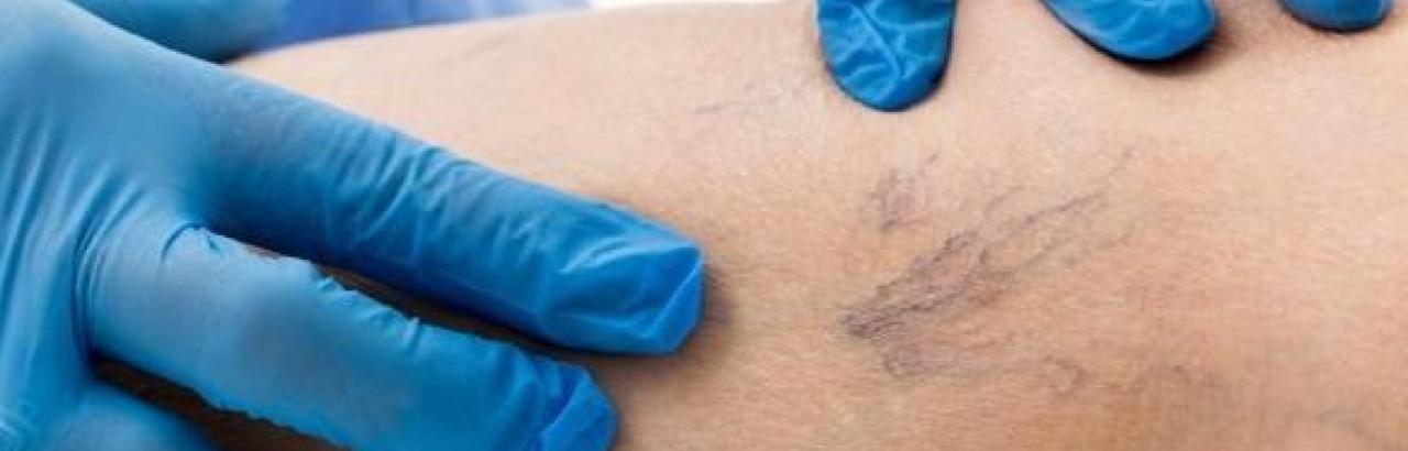 Gloved hands touching a leg