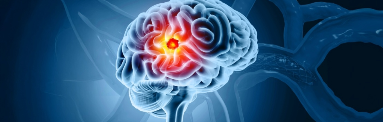 brain