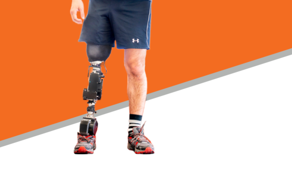 Open Source Bionic Leg