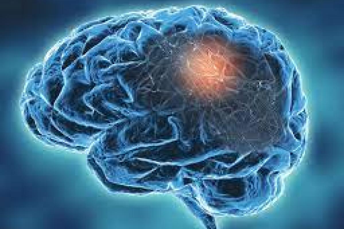 Listing functional neurological disorder