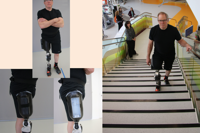 Open-Source Bionic Leg