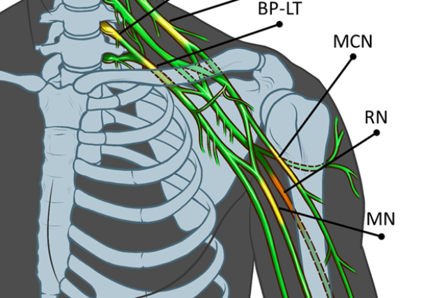 peripheral nerve image