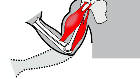 spasticity