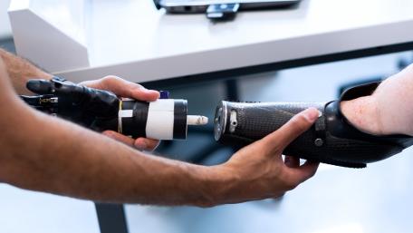 prosthetic arm for upper limb amputation