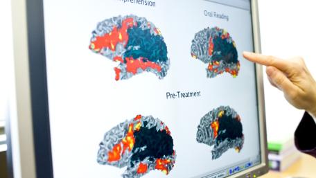 Intensive therapy programs look at the underlying cause of aphasia