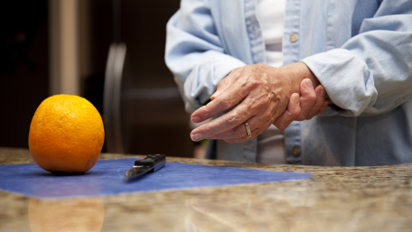 Arthritis can be improved with therapy