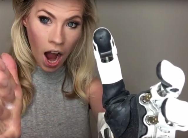 Nicole Kelly uses new bionic arm