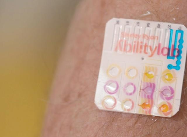 example of a sweat sensor developed at Shirley Ryan AbilityLab