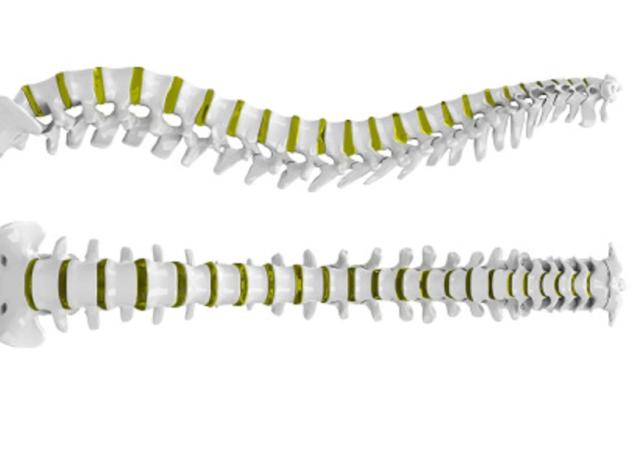 spine model