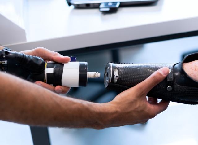 prosthetic arm for upper limb amputation