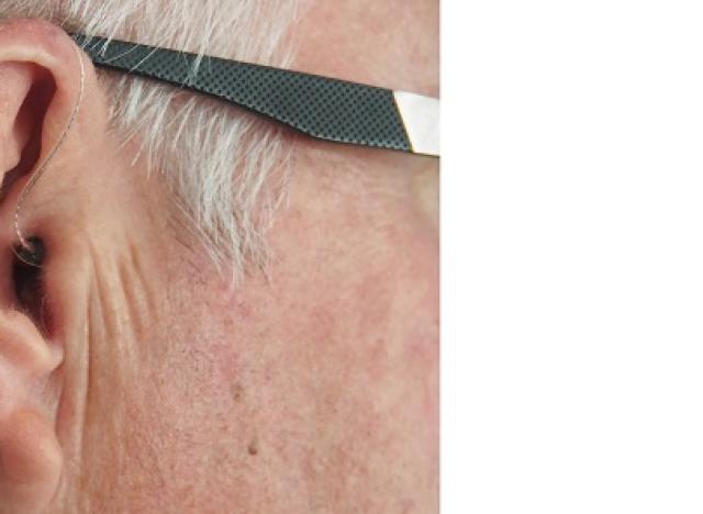 ear and hearing aid with glasses 