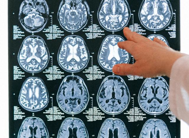 Brain Scan