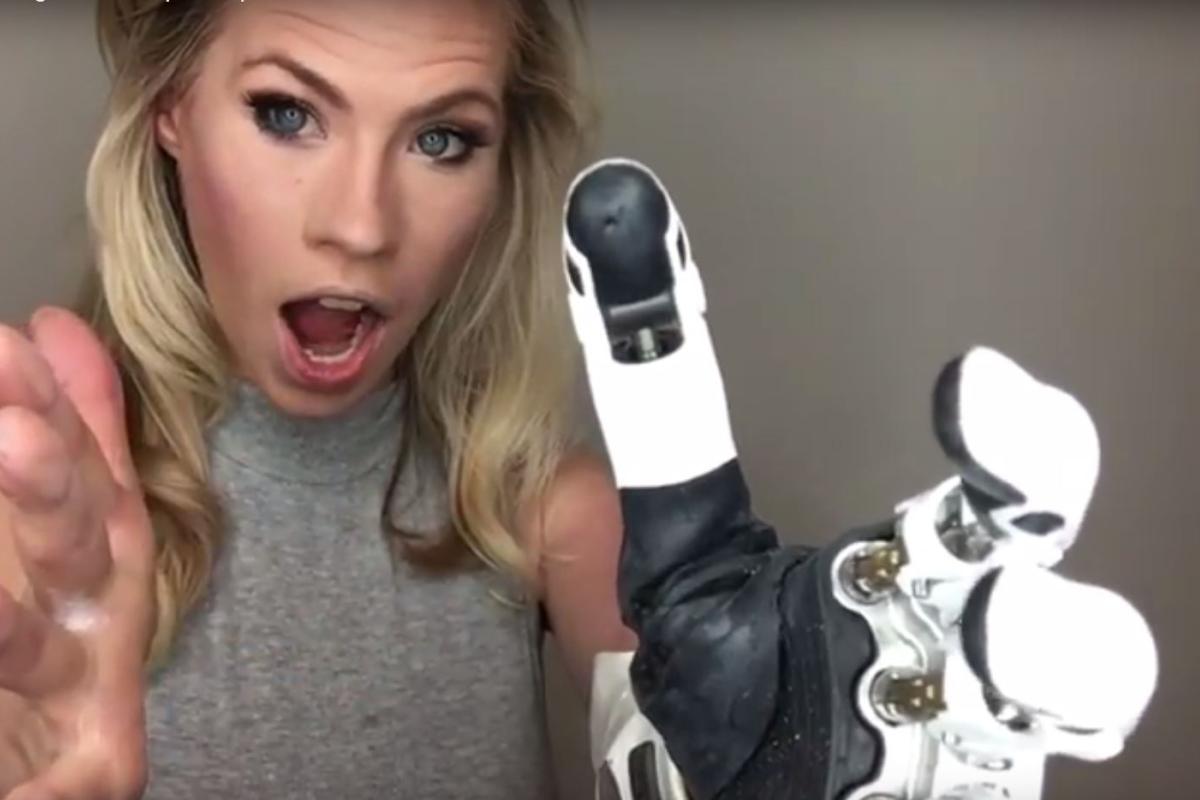 Nicole Kelly uses new bionic arm