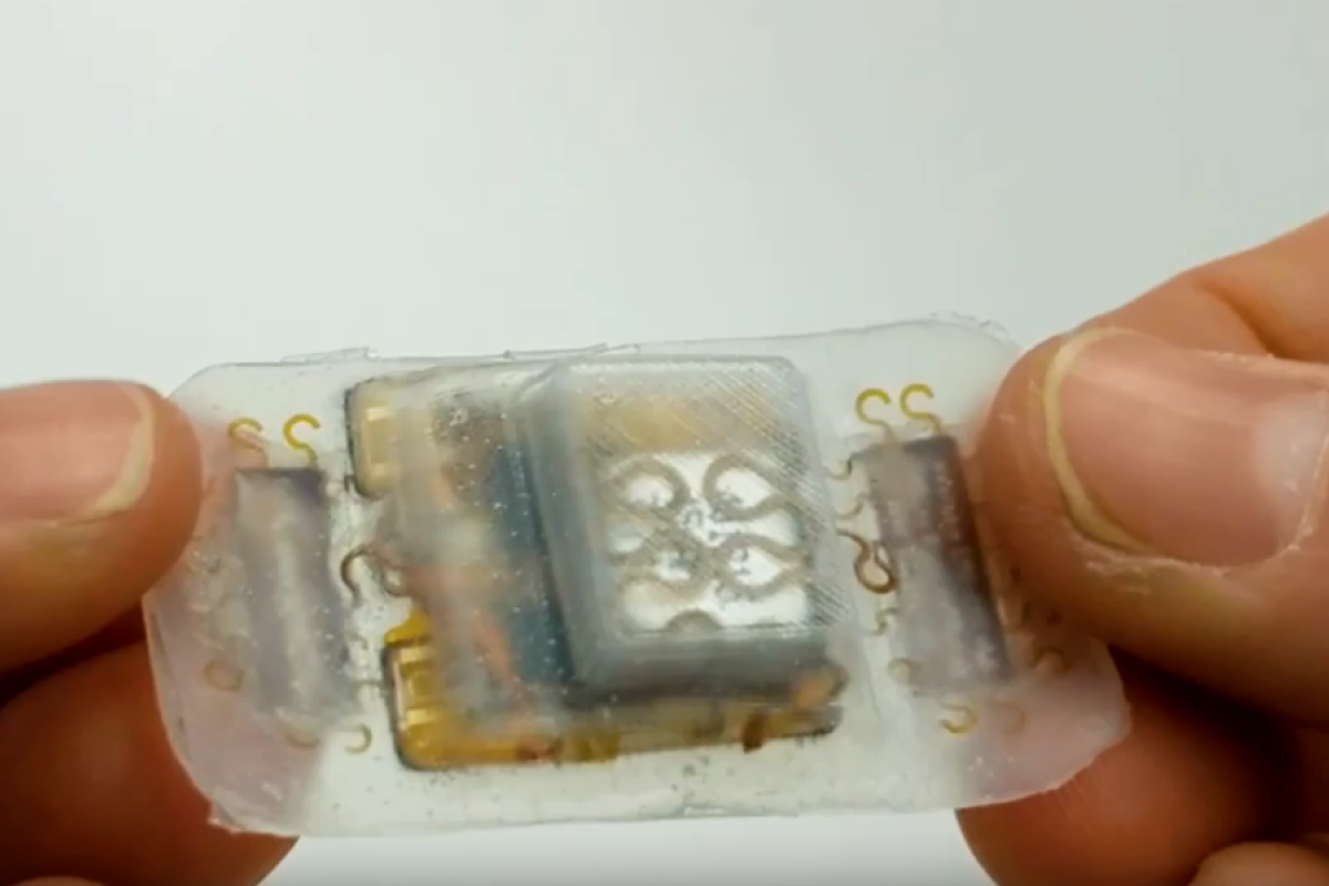 wearable sensor